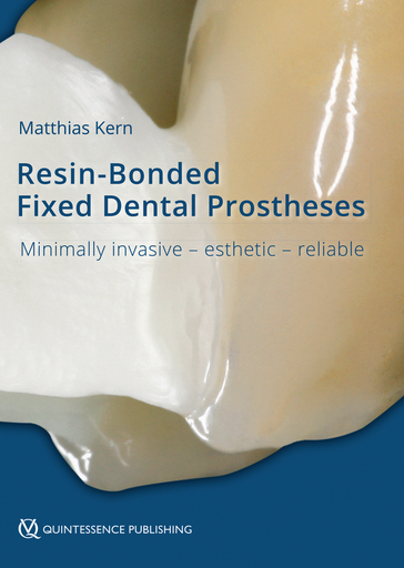 [978-1-78698-020-5] RBFDPS - RESIN-BONDED FIXED DENTAL PROSTHESES MINIMALLY INVASIVE - ESTHETIC - RELIABLE