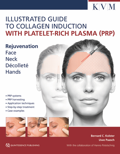 [978-1-78698-029-8] ILLUSTRATED GUIDE TO COLLAGEN INDUCTION WITH PLATELET-RICH PLASMA (PRP) REJUVENATION FACE | NECK | DÉCOLLETÉ | HANDS