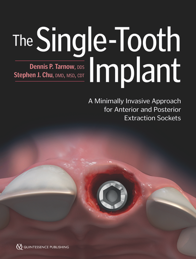 [978-0-86715-771-0] THE SINGLE-TOOTH IMPLANT A MINIMALLY INVASIVE APPROACH FOR ANTERIOR AND POSTERIOR EXTRACTION SOCKETS