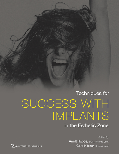 [978-0-86715-822-9] TECHNIQUES FOR SUCCESS WITH IMPLANTS IN THE ESTHETIC ZONE