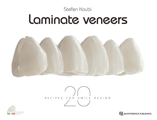[978-2-36615-055-1] LAMINATE VENEER 20 RECIPES FOR SMILE DESIGN