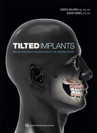 [978-0-86715-818-2] TILTED IMPLANTS IMPLANT-PROSTHETIC REHABILITATION OF THE ATROPHIC PATIENT