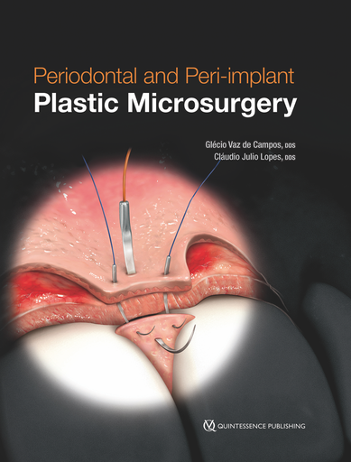 [978-0-86715-819-9] PERIODONTAL AND PERI‑IMPLANT PLASTIC MICROSURGERY MINIMALLY INVASIVE TECHNIQUES WITH MAXIMUM PRECISION